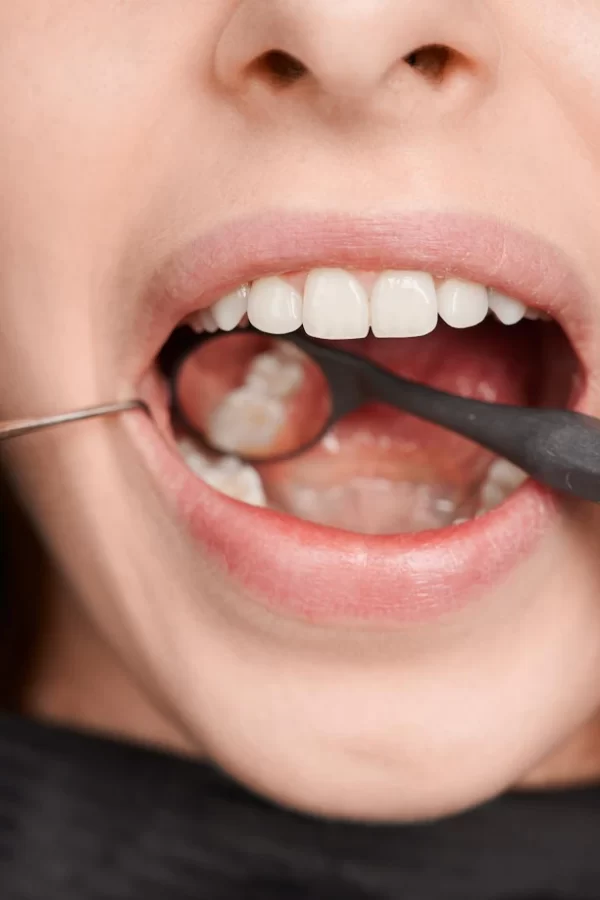 img-especialidades-periodontia-18