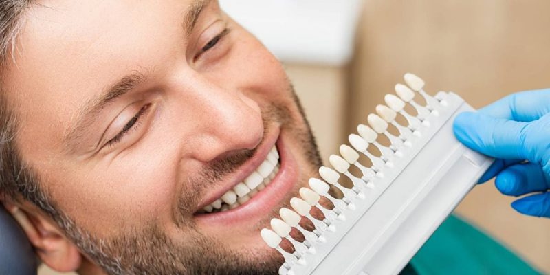 implante-dentario-1-scaled-1